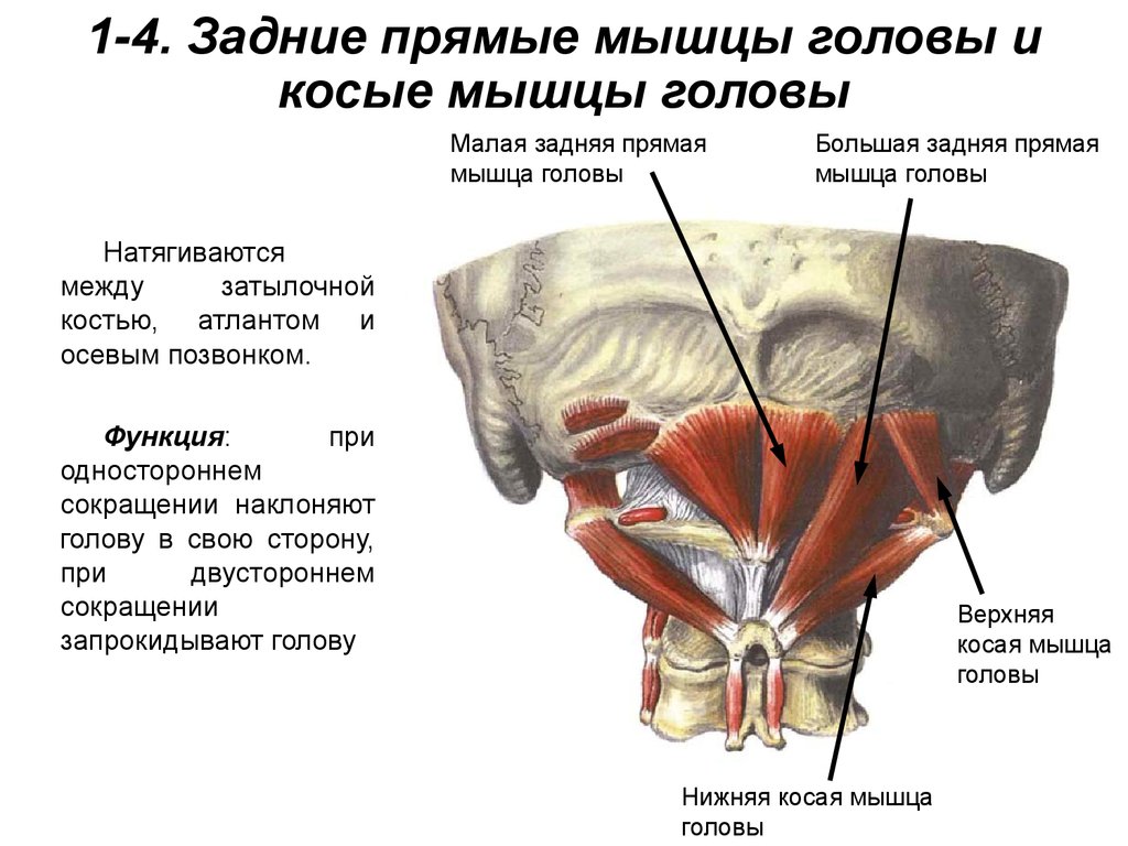 Головные боли